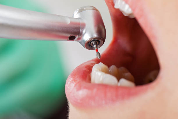 Best Emergency Treatment for Jaw Pain or Injury in Mpbell, CA